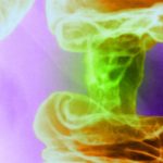 A New Light-Based Cancer Treatment Kills Tumor Cells and Spares Healthy Ones